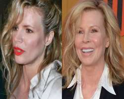 Kim Basinger before surgery